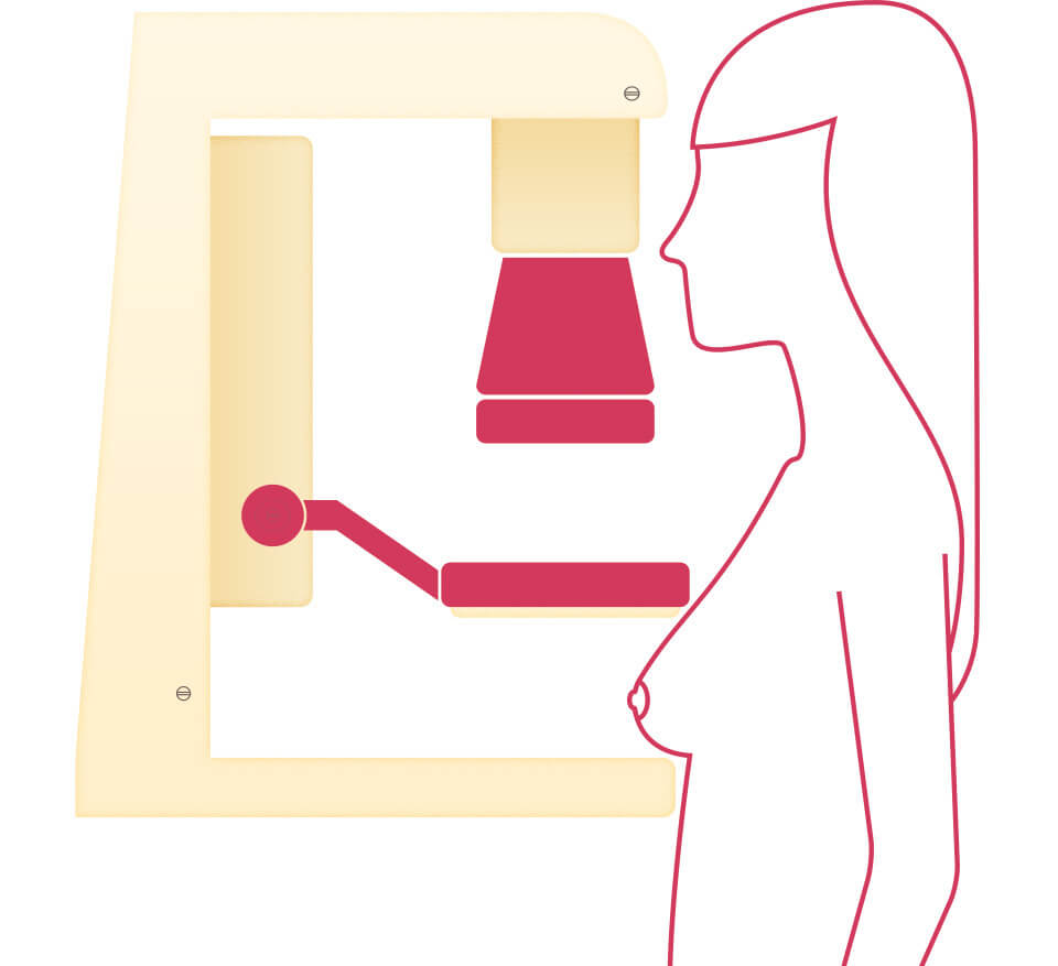 旁站诊断乳房X射线机旁的妇女轮廓说明