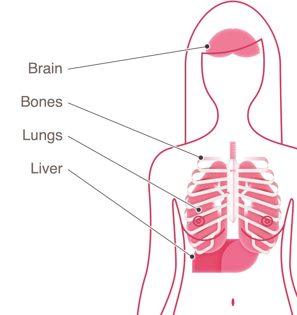显示女性上身突出脑、骨骼、肺和肝