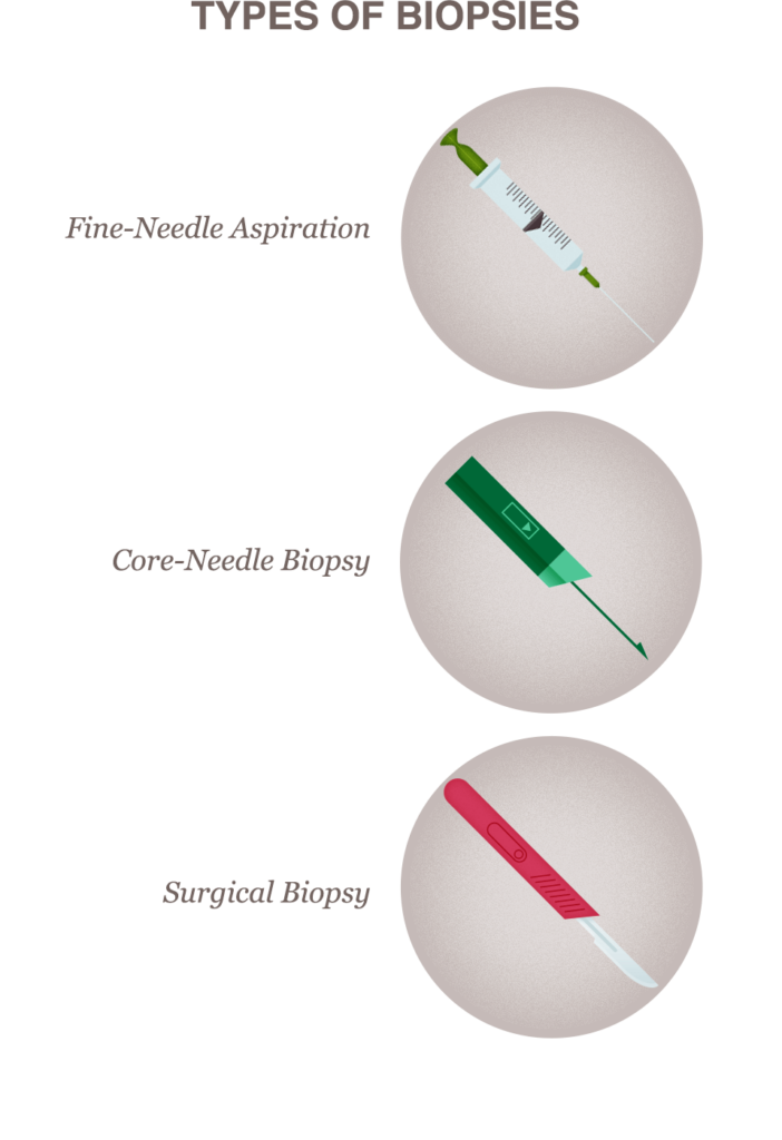 三种例子显示不同类型的工具在不同类型乳房切片程序中使用:细针、芯针和手术刀